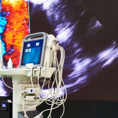 Tactile Systems Stock Analysis: What the Price Signals